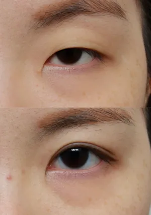 After