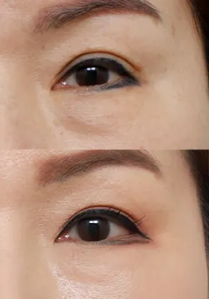 After