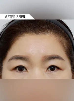 After