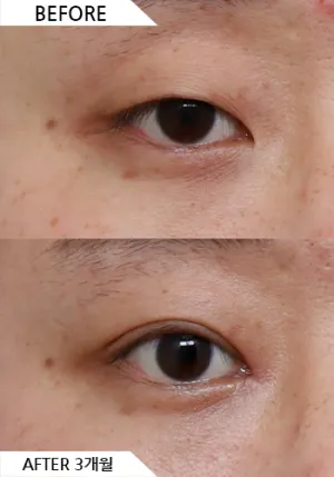 Before