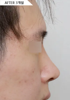 After