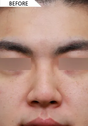 Before