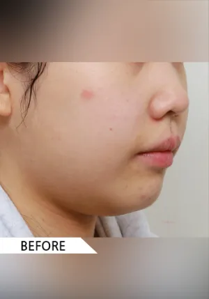 Before