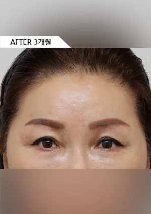 After