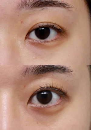 After