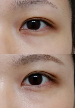 After