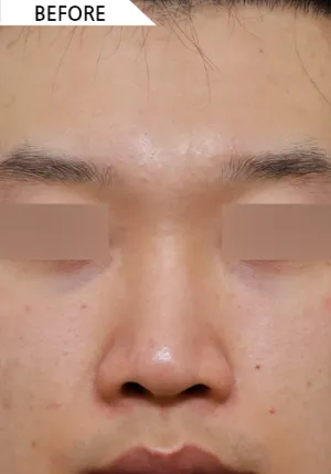 Before