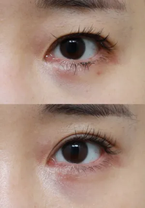 After