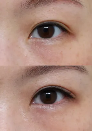 After