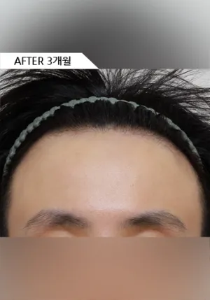 After