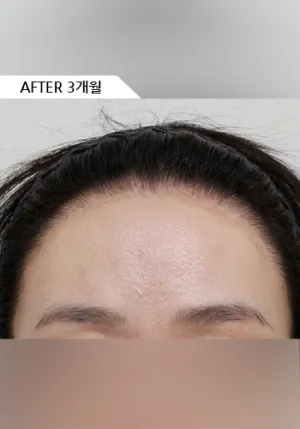 After