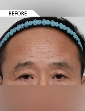 Before