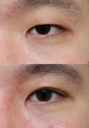 After