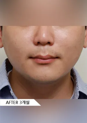 After