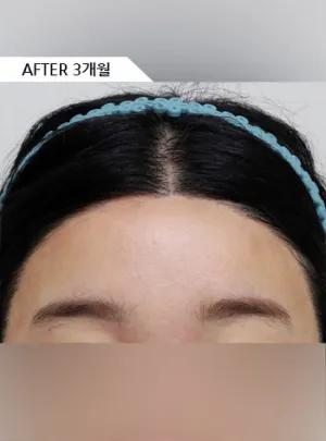 After
