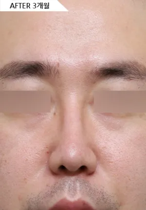 After