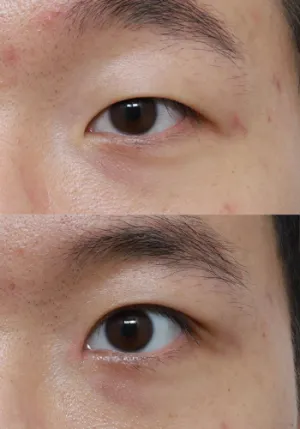 After