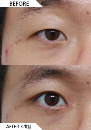 Before
