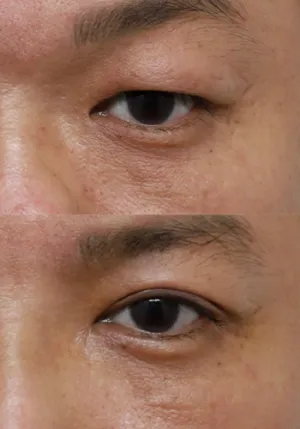 After
