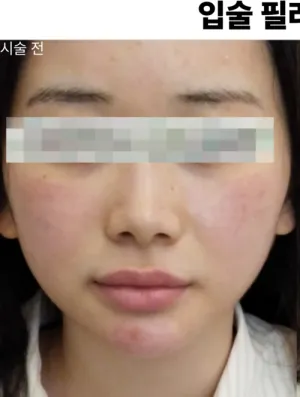 Before