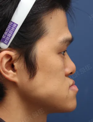 Before