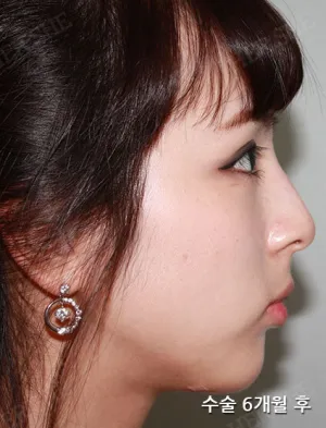 After