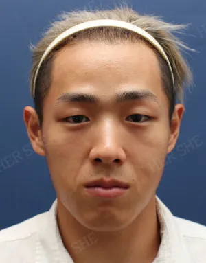 Before