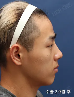 After
