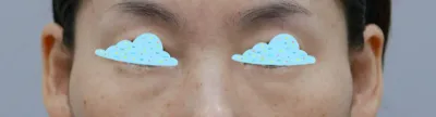 Доод зовхины мэс заслын дараах сэтгэгдэл~