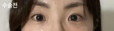 [Нүд] ㅈㅎㅊ - Нүд