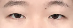 Before