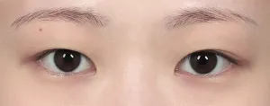 Before